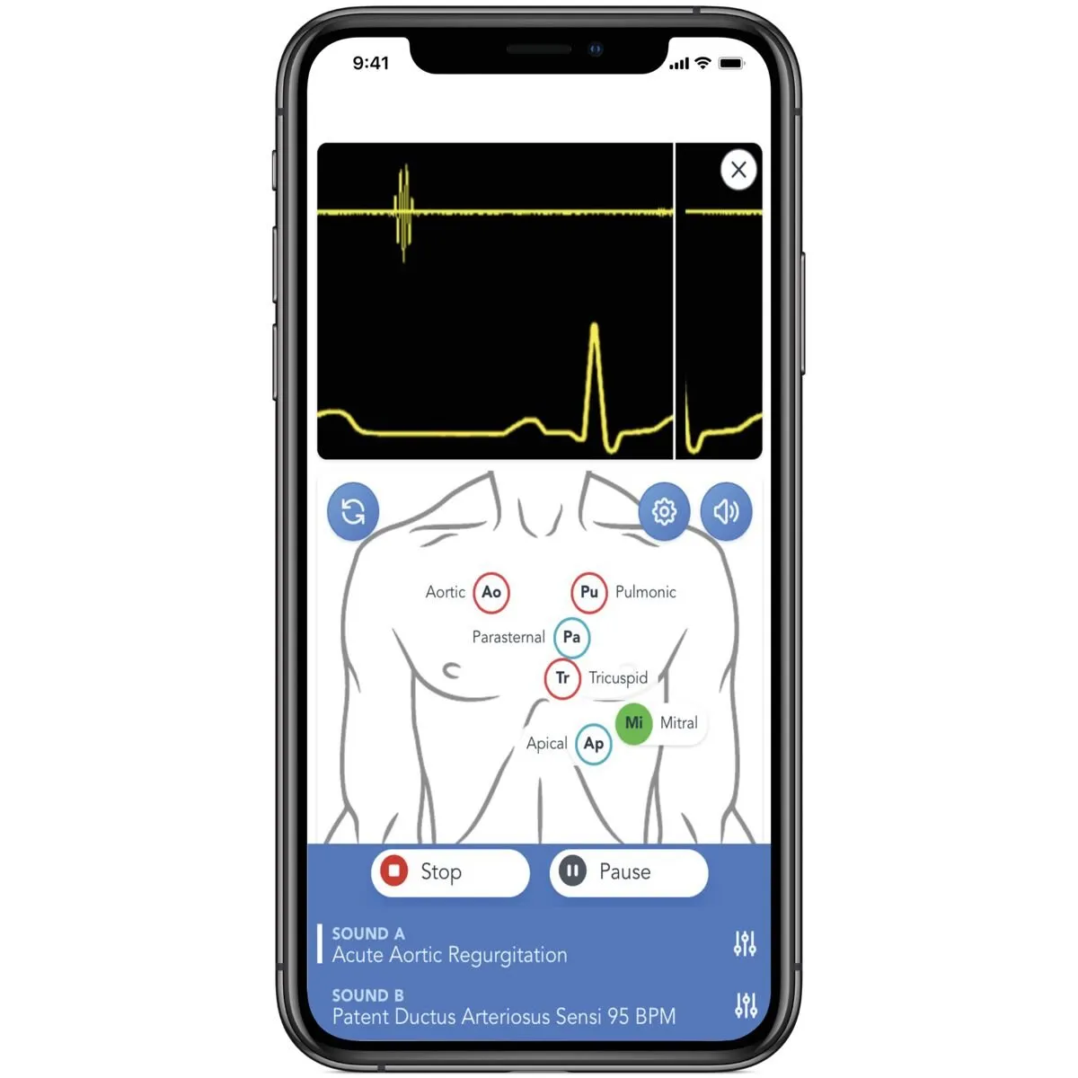 SAM4 Auscultation Manikin, Dark